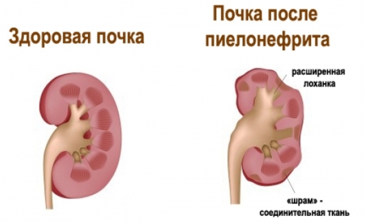 Диспансерное наблюдение