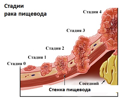 rak gorla