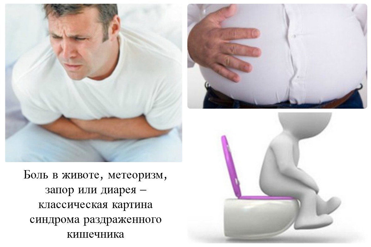 Симптомы синдрома раздраженного кишечника