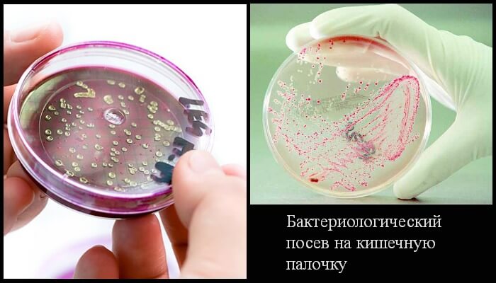 kishka palka