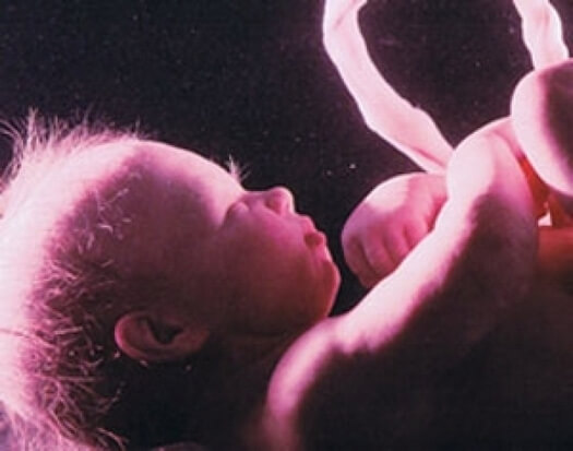 27 week beremennost