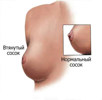 sosky