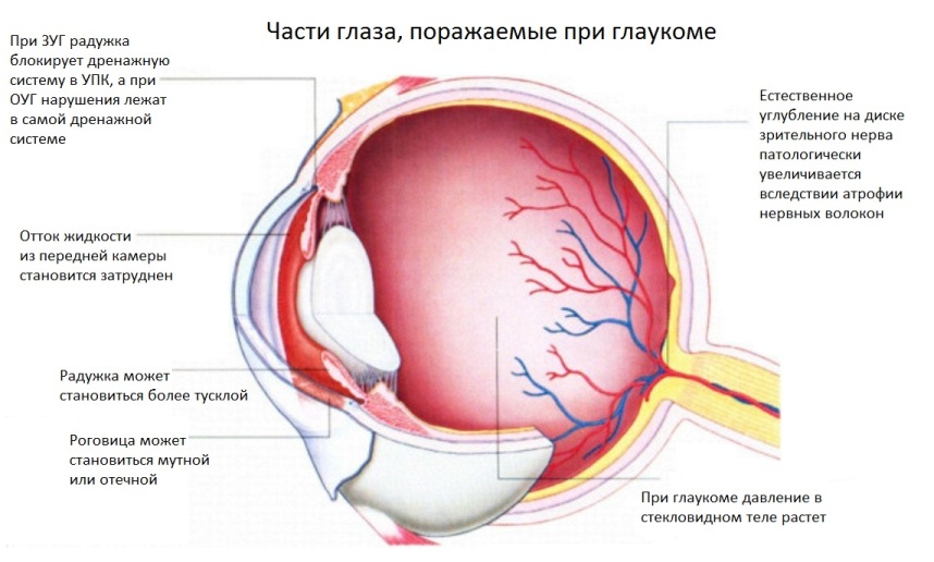 Части-глаза-поражаемые-при-глаукоме