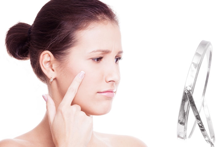 External-Adult-Acne-MEDIA-720