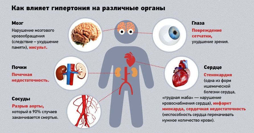 Гипертония 2