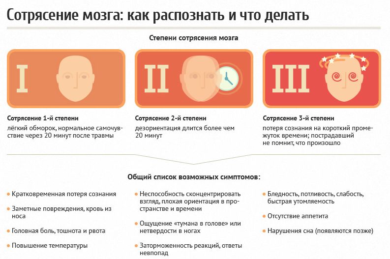 Сотрясение мозга