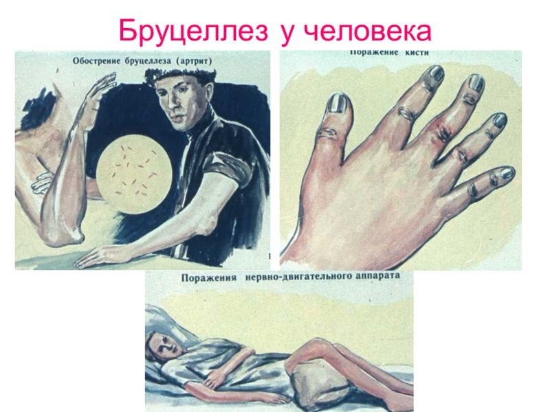 berres-min
