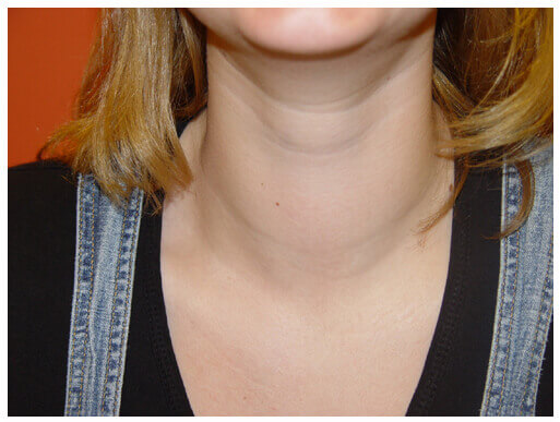 http://thyroid-consultor.ru/wp-content/uploads/2015/01/big.jpg