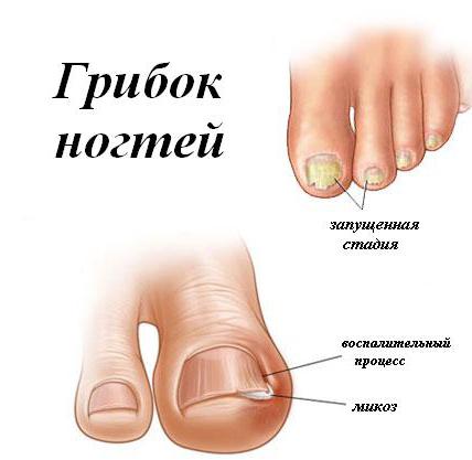 Насколько важно обращение к врачу