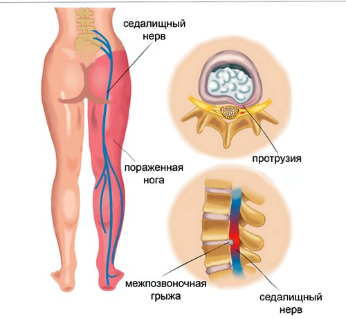 Когда нужна срочная медицинская помощь