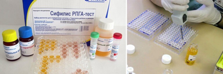 diagnostika-sif