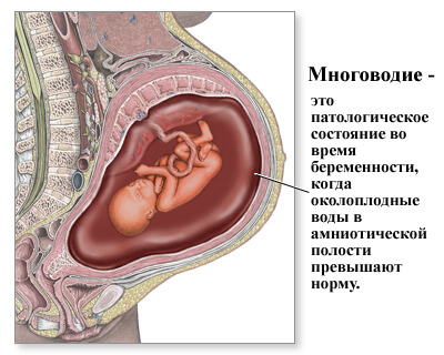 mnogovodie