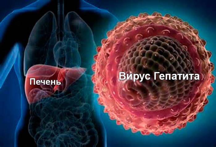 Гепатит А