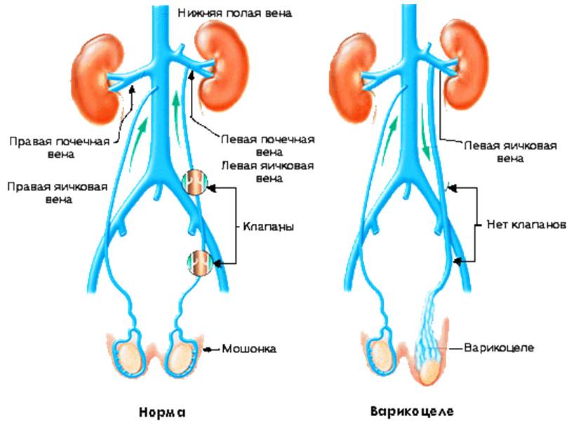 urologia