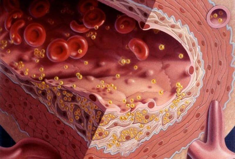 lipido
