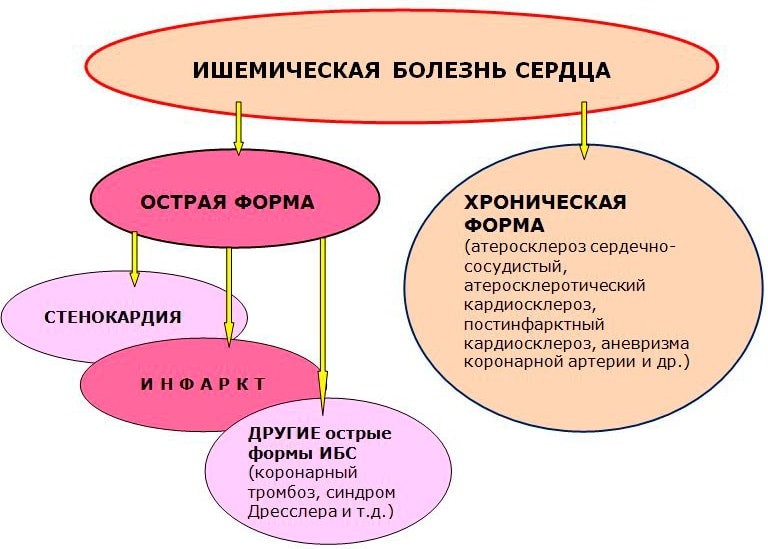 Классификация ишемической болезни сердца