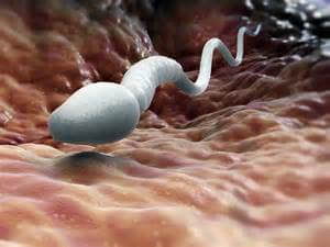nekrospermia