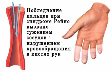 Сердечно-сосудистая система