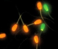 nekrozoospermiya