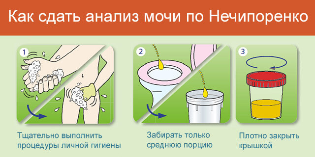 pravila-sdachi-analiza-mochi-po-nechiporenko