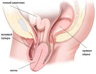 prolapse