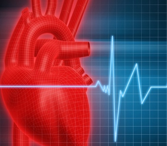 infarkt