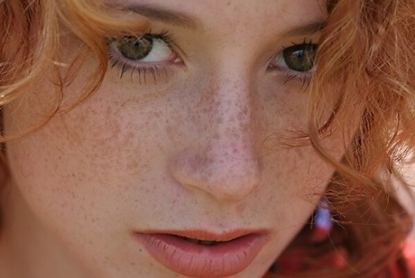 vesnushki