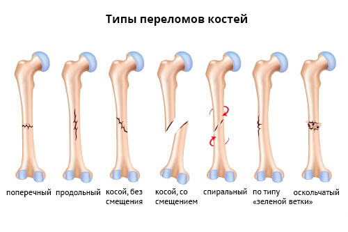 vidi_perelomov