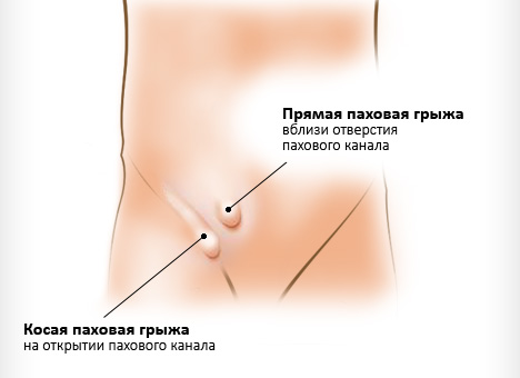 vidy-pahovyh-gryzh