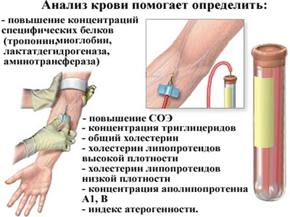 Особенности анализа крови Особенности анализа крови