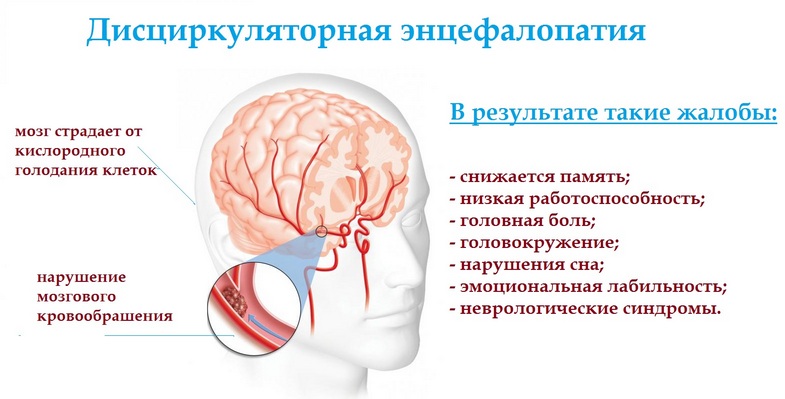 Особенности дисциркуляторной энцефалопатии Особенности дисциркуляторной энцефалопатии