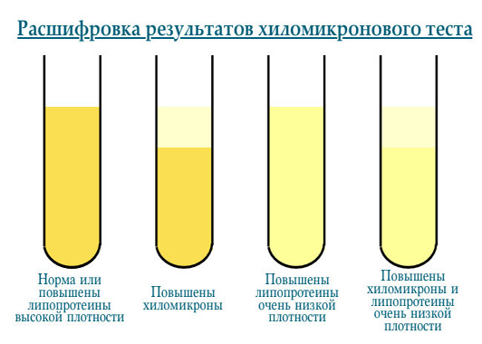 Результаты хиломикронового теста Результаты хиломикронового теста